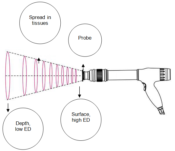 SHOCKWAVE THERAPEUTIC APPARATUS Treatment Theory