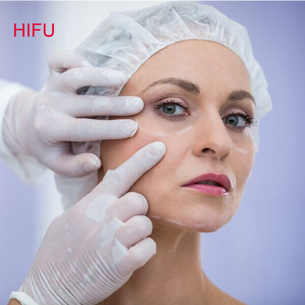 HIFU ultrasound facelift machine solves skin laxity and wrinkles