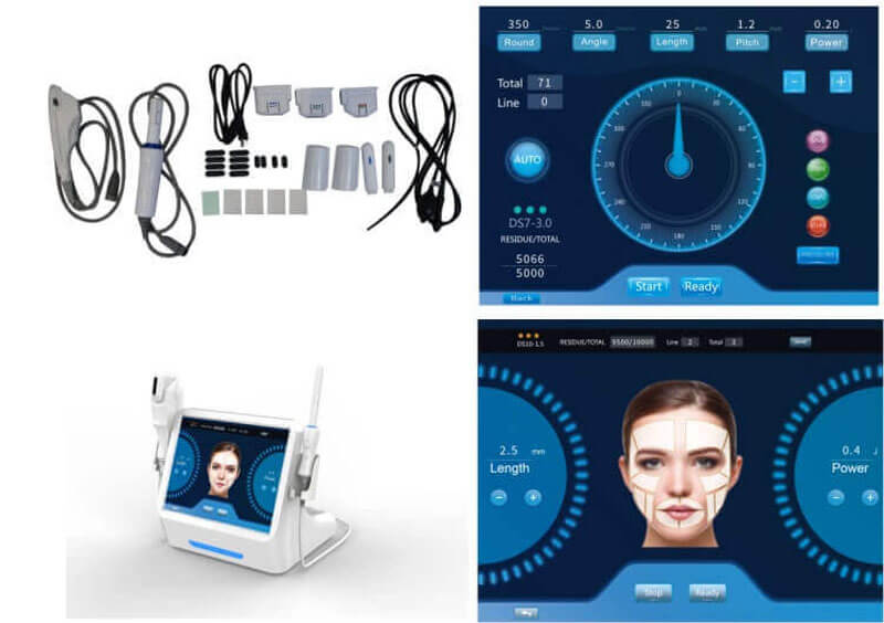 Efficacy and side effects of ultrasound HIFU beauty machine