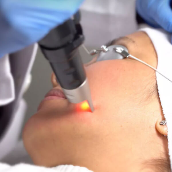 High tech beauty picosecond laser