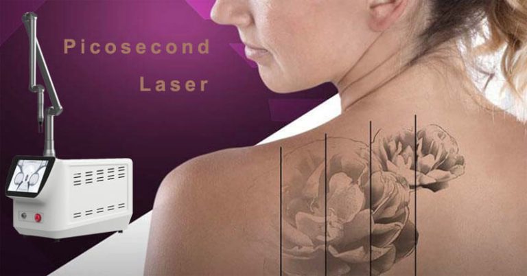 Picosecond Laser Vs Q Switched Laser Tattoo Removal Bestview Laser