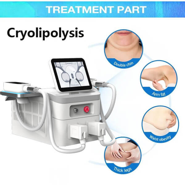 HIFU vs Cryolipolysis: Which is better for fat loss?