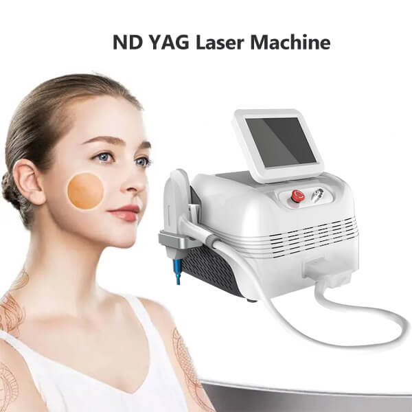 What does the ND YAG laser skin treatment involve?