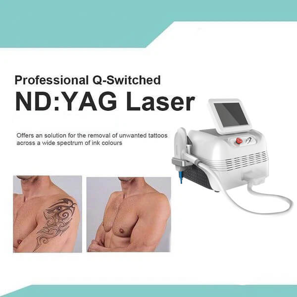 ND YAG Laser for Skin Treatment – Spots Removal