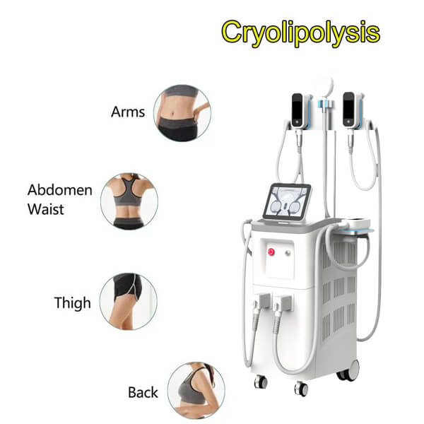 Cryolipolysis – The Nonsurgical Fat Reduction Procedure