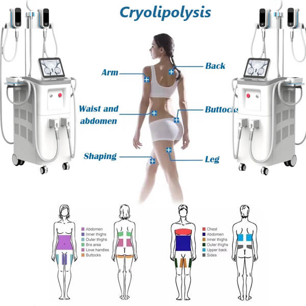 Do you lose weight when you do cryolipolysis treatment？