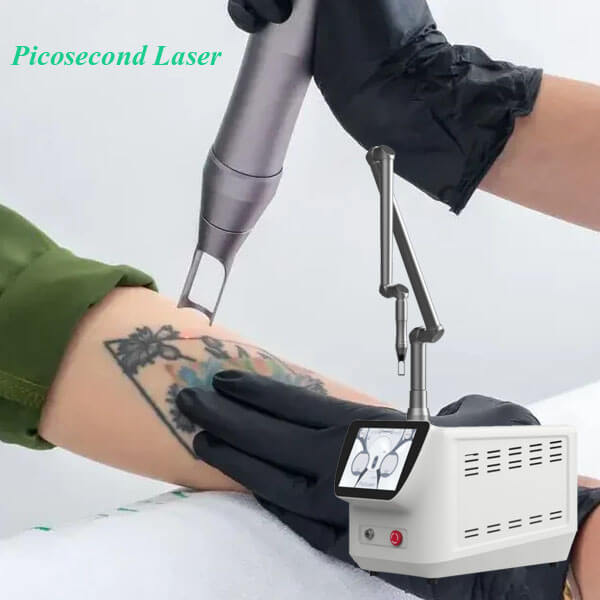 3 ways you can make the most out of picosecond laser