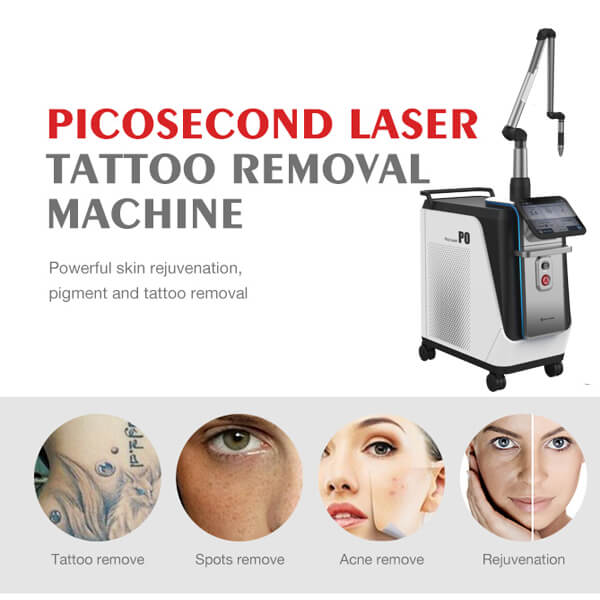 Picosecond laser to have a skin with a uniform tone