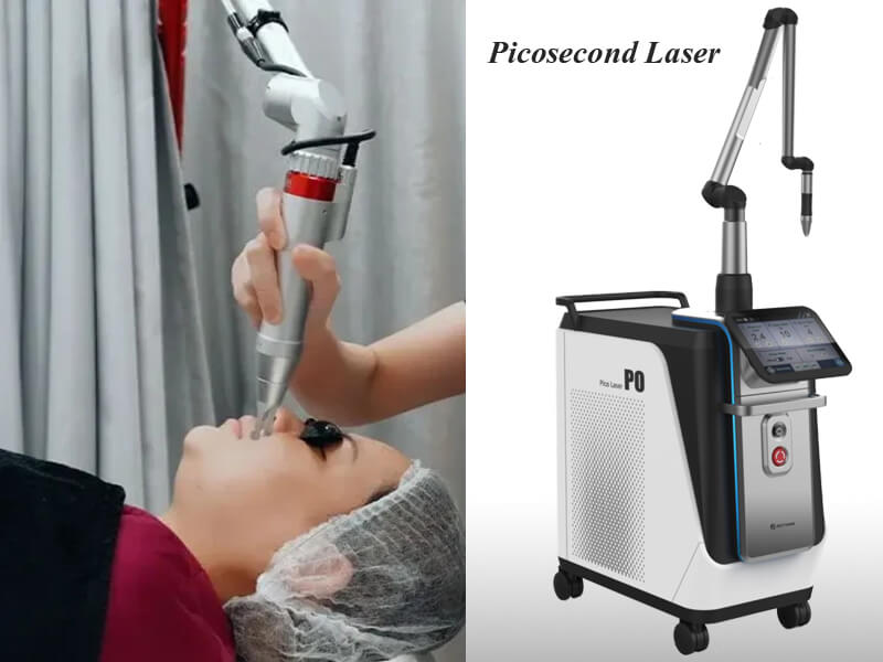 oem picosecond laser machine