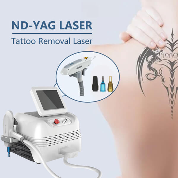Get to know the Q-switched ND YAG laser technology that removal tattoos