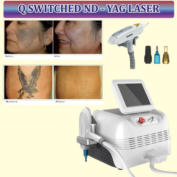 How Does the ND YAG Laser Treat Vascular Lesions and Leg Veins?