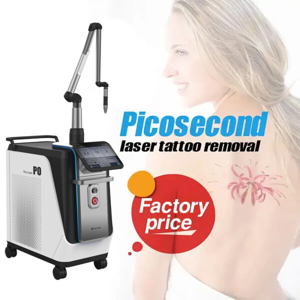 What Is the Best Tattoo Removal Laser?