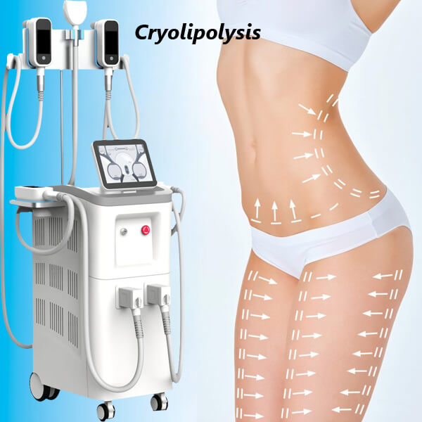 The precautions for cryolipolysis treatment