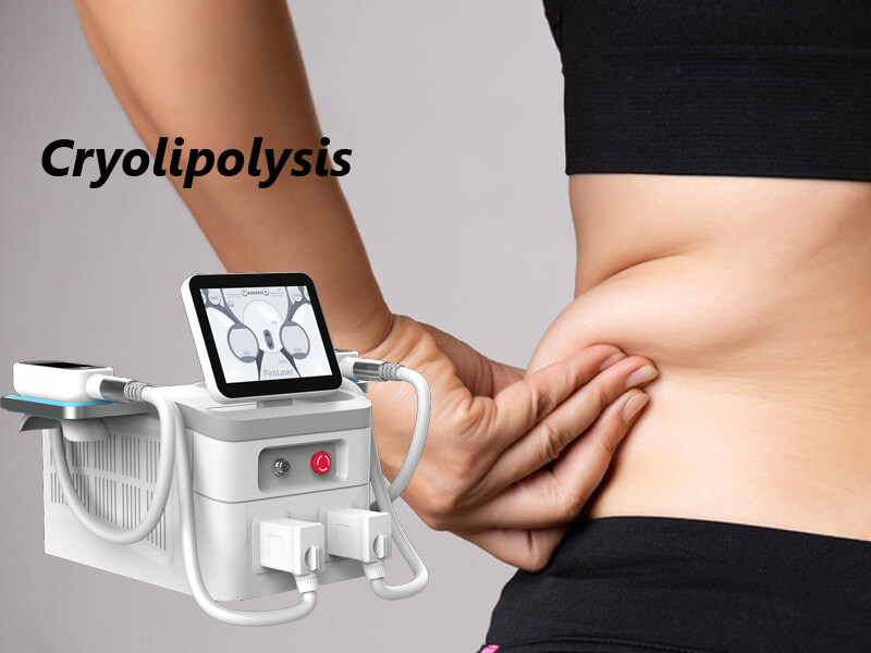 cryolipolysis slimming machine