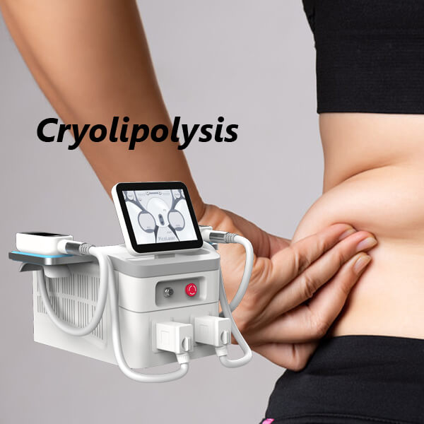 Why cryolipolysis treatment is so popular?