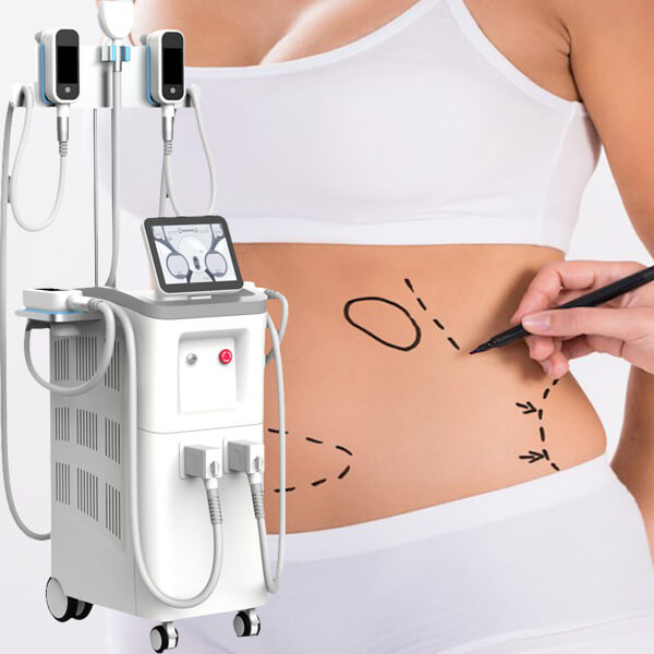 What can you expect from a cryolipolysis session?