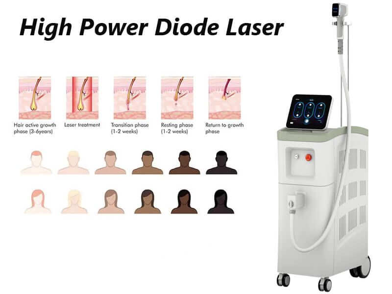 diode laser hair removal machine