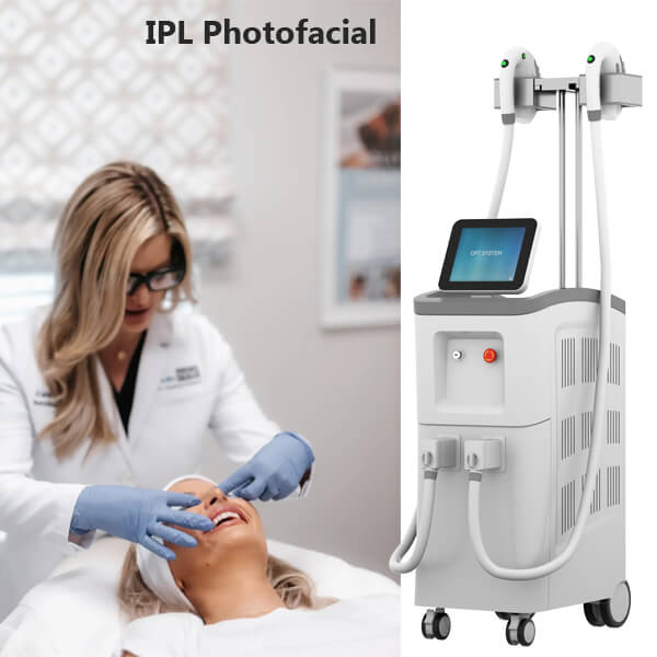 A non-ablative resurfacing technique of IPL treatment