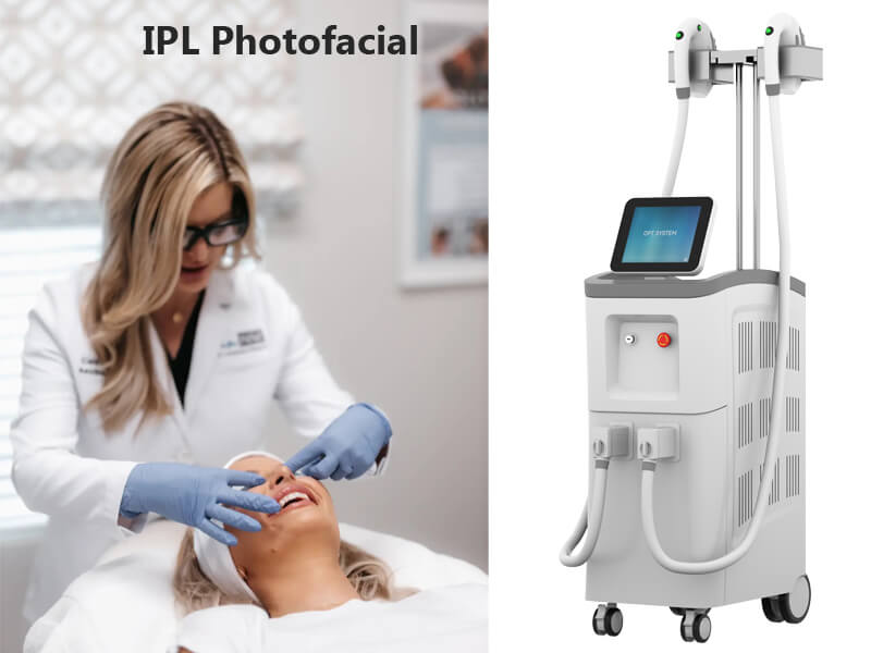 professional ipl machine