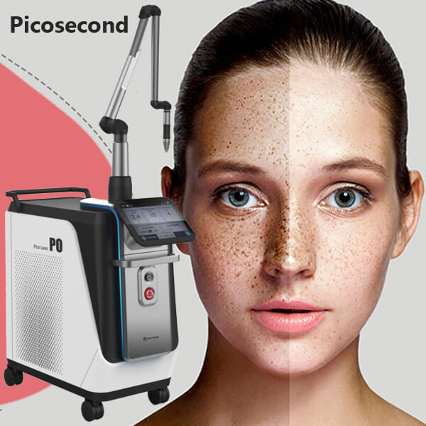 Everything you need to know about the Picosecond laser treatment