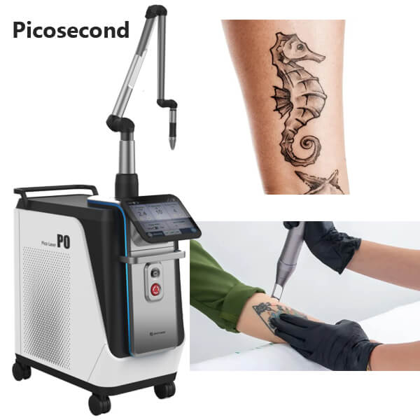 Unlocking Precision: The Power of Picosecond Laser