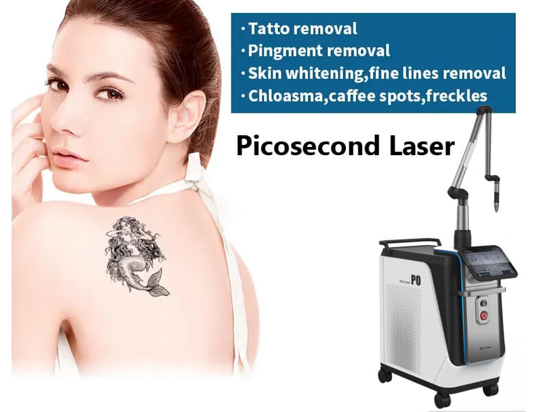 picosecond laser machine