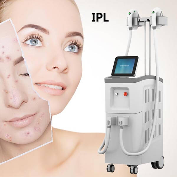 What to expect before, during, and after IPL photofacial treatment