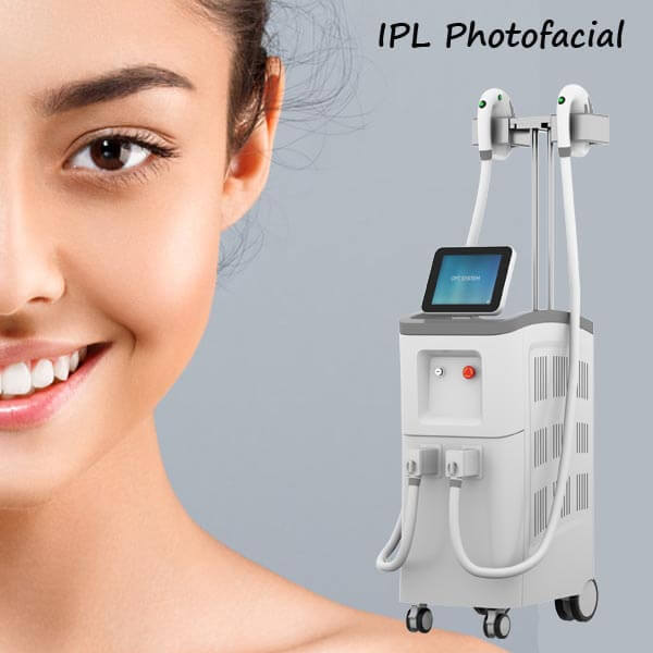 What to expect during IPL treatment