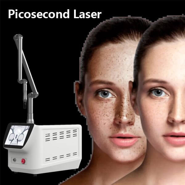 Picosecond laser to clear or minimize melasma