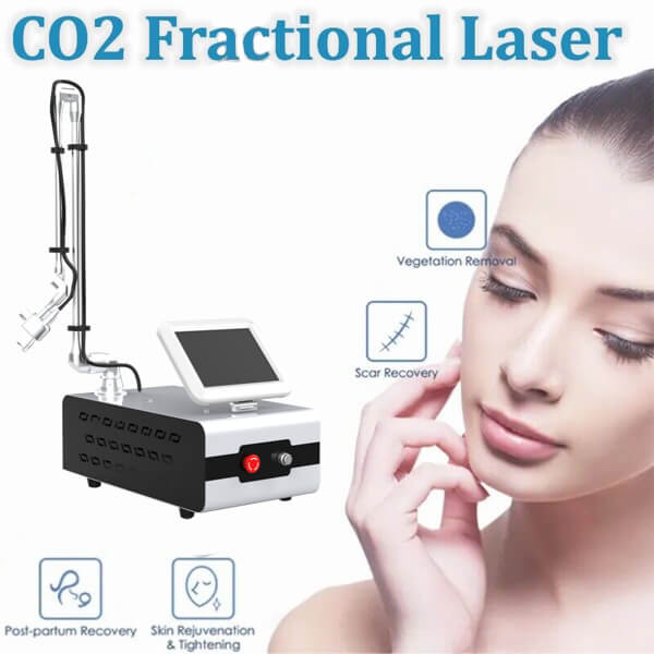 Can CO2 Fractional Laser Treatment Remove Stretch Marks