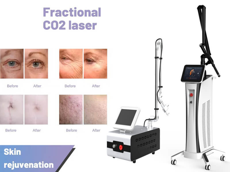 co2 fractional laser machine