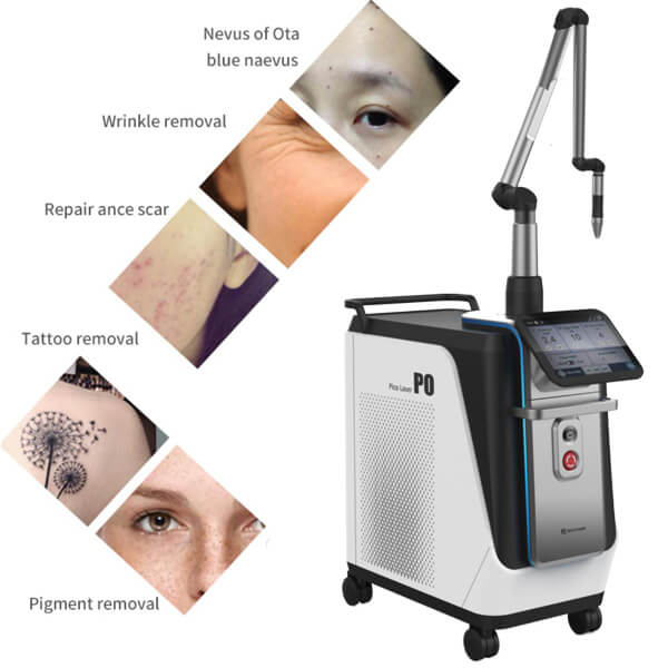 Picosecond laser tattoo removal: your comprehensive guide