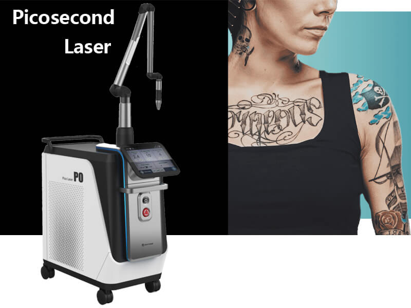 picosecond laser machine