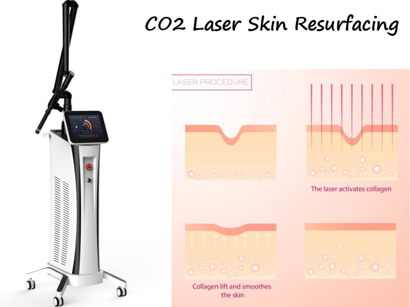 co2 fractional laser machine