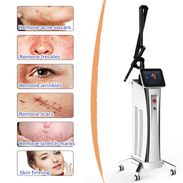 CO2 Laser Skin Resurfacing Skincare Procedure