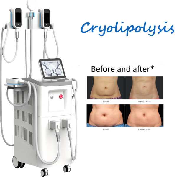 Cryolipolysis Fat Freezing: Non Surgical Fat Reduction, Body Contouring