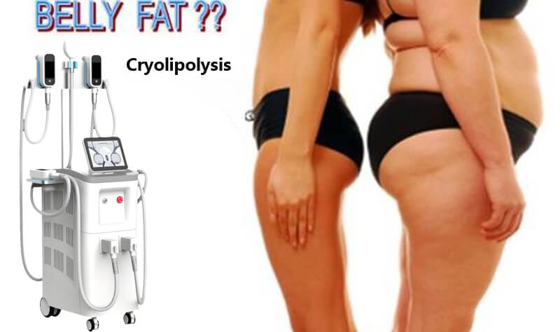 cryolipolysis fat freezing machine