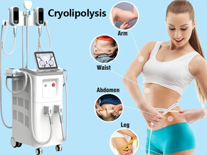 cryolipolysis fat freezing machine