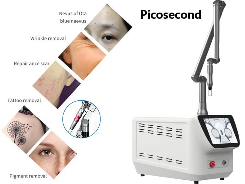 picosecond laser machine