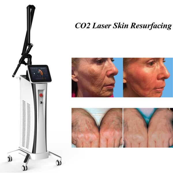 Fractional CO2 Laser Resurfacing Restores Your Skin