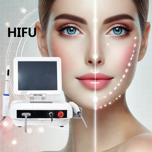 Everything You Should Know About HIFU Facial