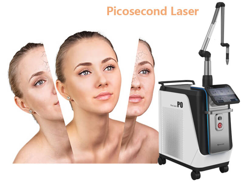 picosecond laser machine