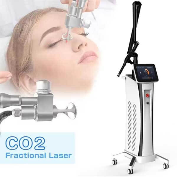 What happens after the CO2 laser treatment?