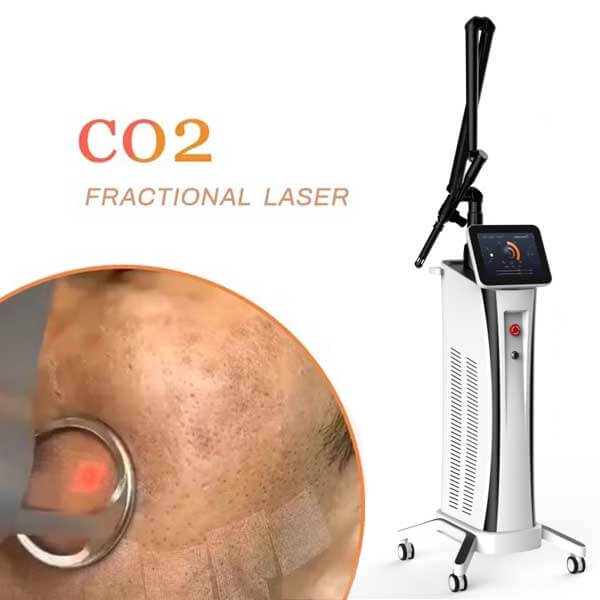 What recovery from CO2 laser resurfacing procedure looks like?