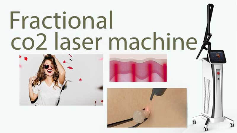 co2 laser treatment machine