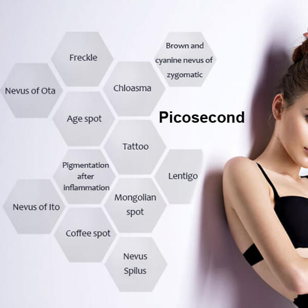 picosecond laser machine