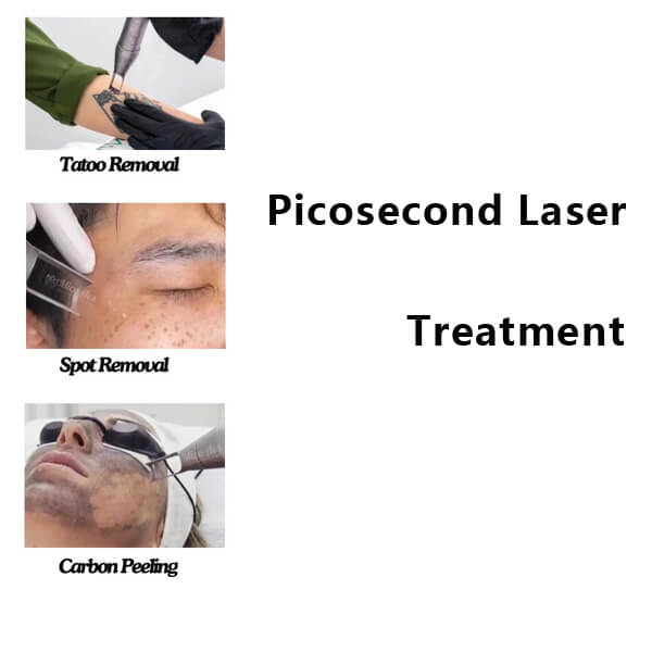 picosecond laser machine