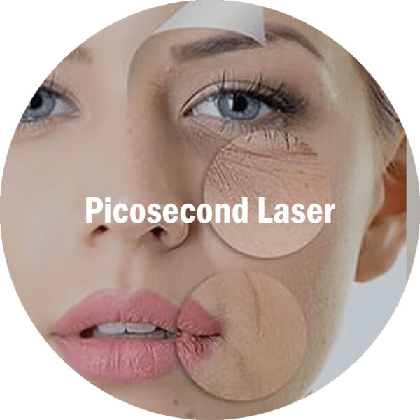 picosecond laser machine