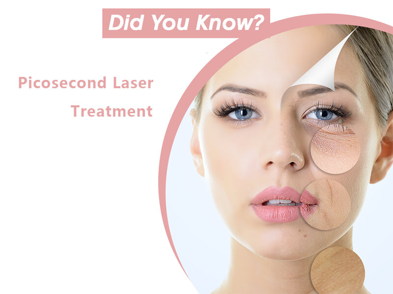 picosecond laser tattoo removal machine