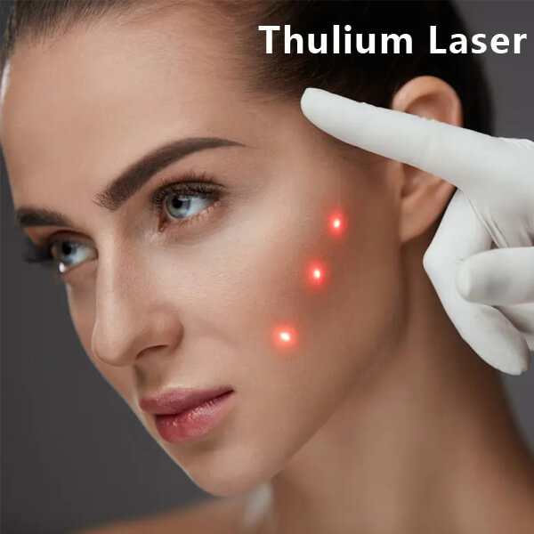 thulium laser machine